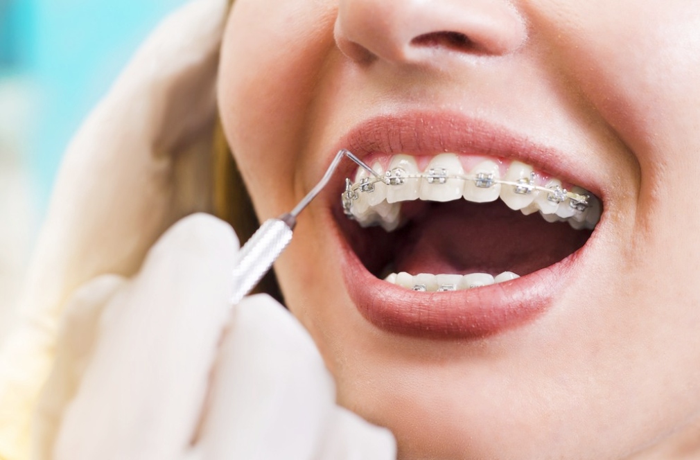 south kolkata best dental clinic