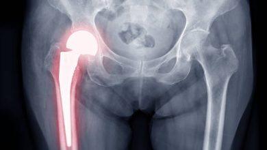 A hip replacement is major surgery, so you should prepare before improving your chances of a favourable outcome and less hip pain.