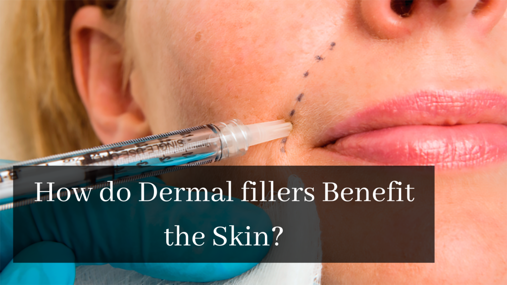 Dermal fillers