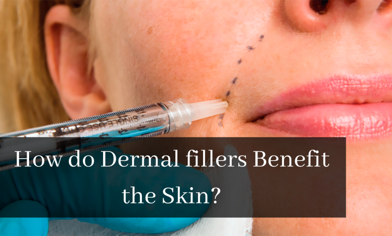 Dermal fillers