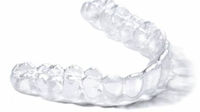 12 Tips For Getting The Best Out Of Your Transparent Aligners